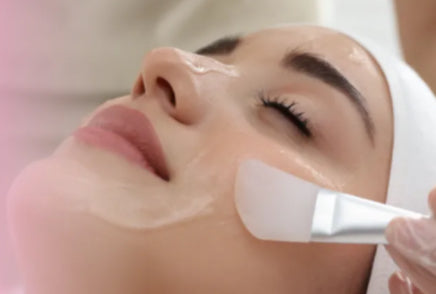 Exfoliación química