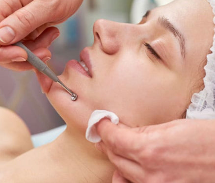 Limpieza profunda acné